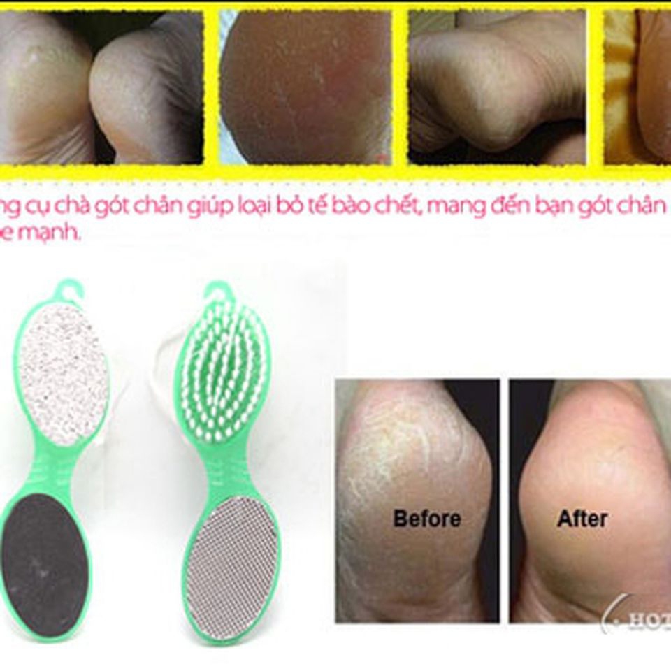 Dụng cụ chà gót chân tiện dụng